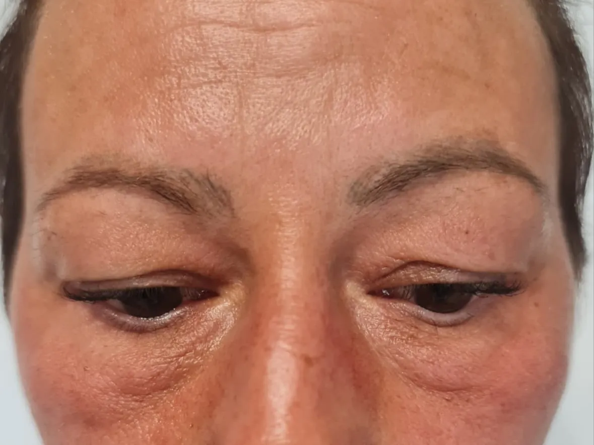 Trucco semipermanente prima della correzione, realizzata a Varese