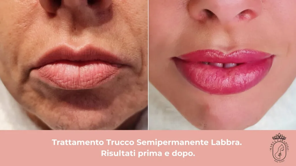 Risultati prima e dopo di un trattamento di trucco semipermanente alle labbra eseguito da Marta Paradiso