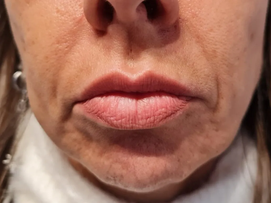 Labbra prima del trucco semipermanente, realizzato a Varese